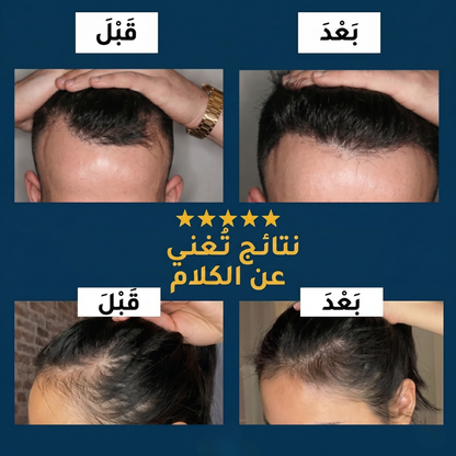 سيروم ريفايف لنمو الشعر