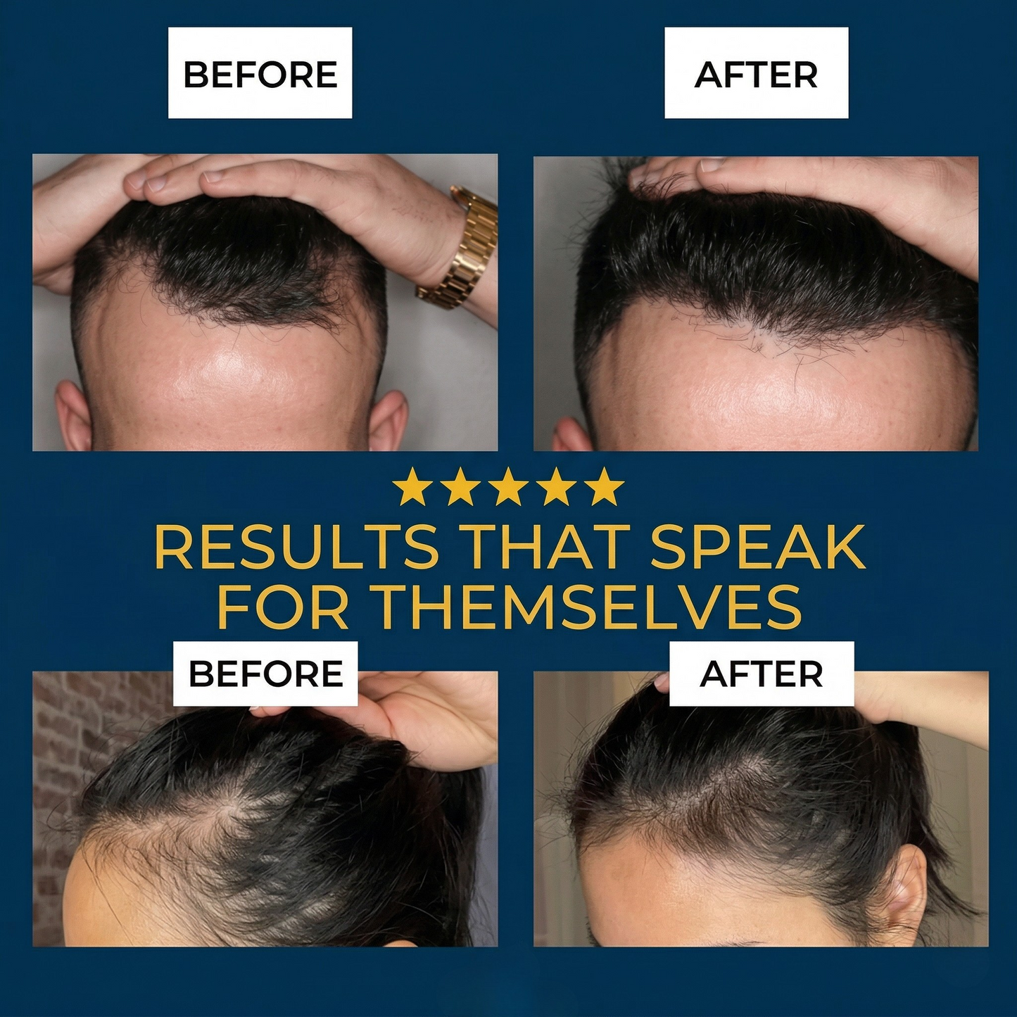 1 Revive Hair Growth Serum